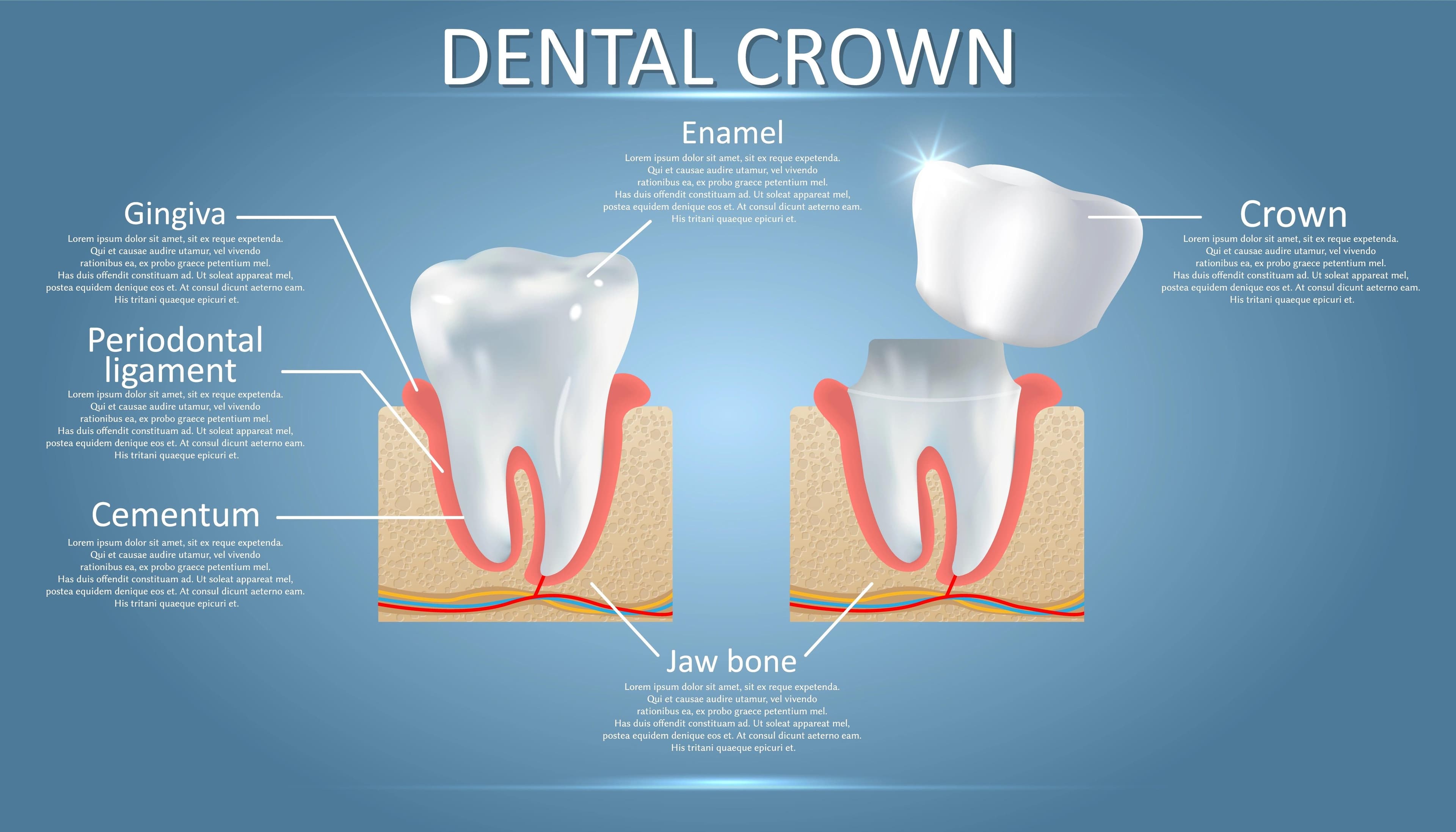 Infographic explaining the parts of a tooth.