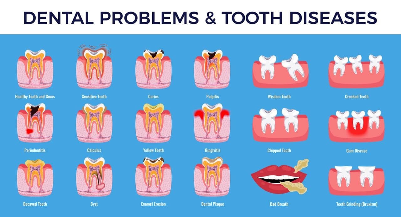 Illustrated infographic showing the different types of dental problems.